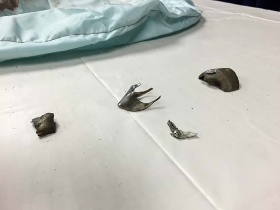 Takata airbag recall metal fragments
